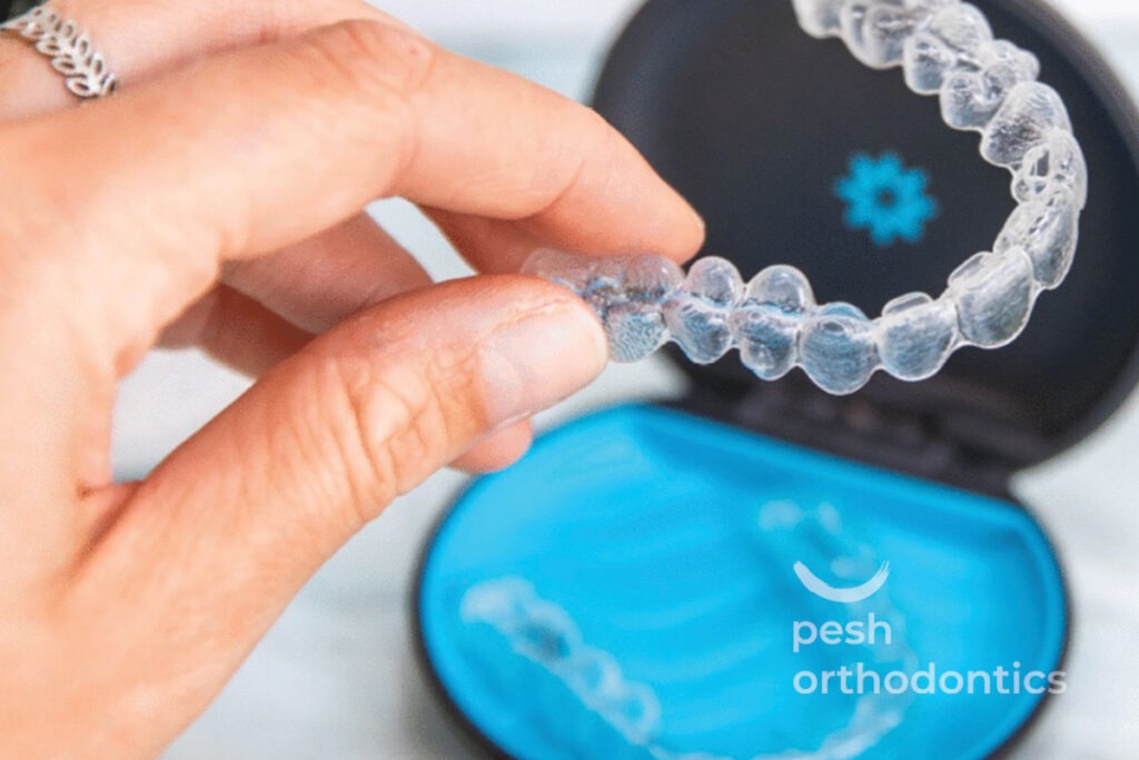 A woman’s hand holding a clear Invisalign aligner, showcasing its transparency and sleek design.