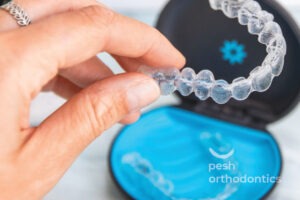 A woman’s hand holding a clear Invisalign aligner, showcasing its transparency and sleek design.