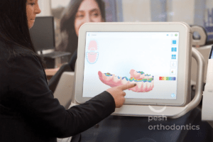 Pesh Orthodontics staff member explaining 3D digital scan of a patient's mouth on screen