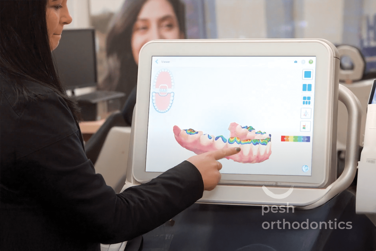Pesh Orthodontics staff member explaining 3D digital scan of a patient's mouth on screen